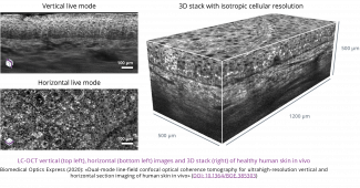 images LCT-OCT verticale, horizontale et en 3D de peau humaine in vivo