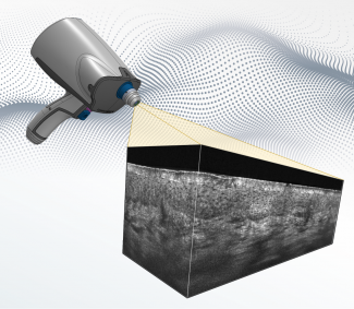 nouveau dispositif de LC-OCT, basé sur l'interférométrie tandem