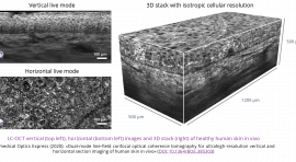 images LCT-OCT verticale, horizontale et en 3D de peau humaine in vivo