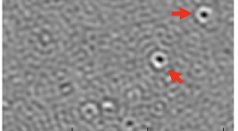 Image de microscopie exaltée par cavité résonante mettant en évidence la présence de protéines d’Apoferritine