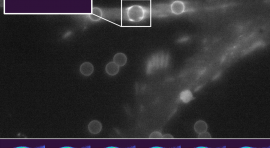 Pince optique et microscopie de fluorescence FRET 